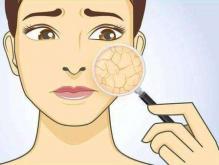 冬季皮肤干燥粗糙怎么办？皮肤保湿方法小技巧